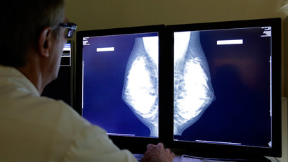 ‘Sea sponge’ drug may extend life for breast cancer patients