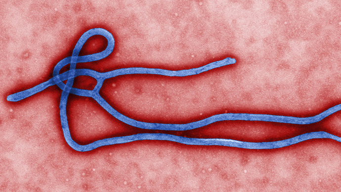 Ebola's incubation period spans two to 21 days. Symptoms include high fever, bleeding and damage to the nervous system. 