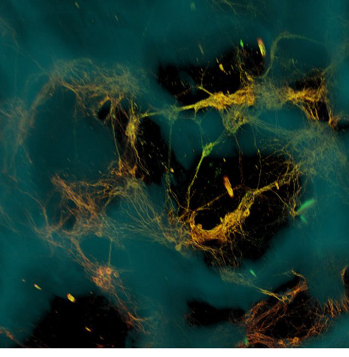 Confocal microscope image of neurons, courtesy of Tufts University.