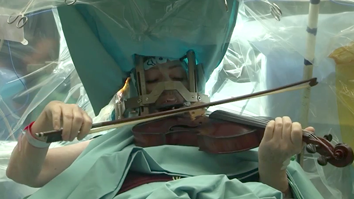 Violinist plays Mozart during brain surgery to conquer 20-year hand tremor (VIDEO)