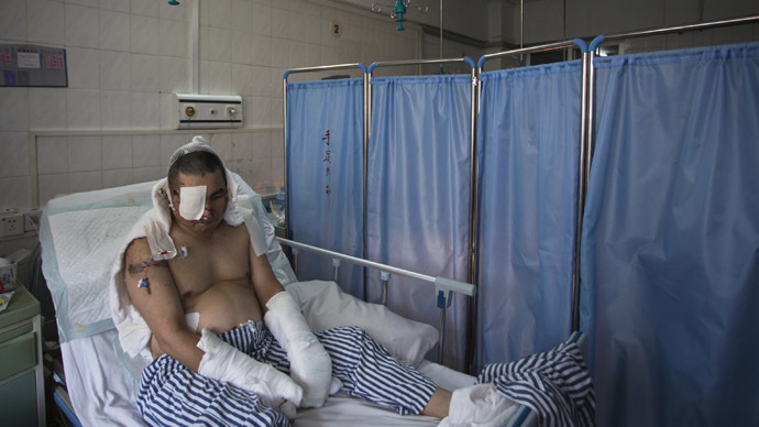Li Jianxin, a blogger and online whistleblower, lies on a bed waiting for a fourth operation at a hospital in the southern Chinese city of Huizhou, Guangdong province July 23, 2013. (Reuters/Tyrone Siu)