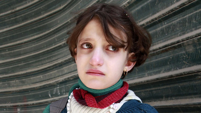 Police mistakenly arrest people having epileptic seizures - health charity