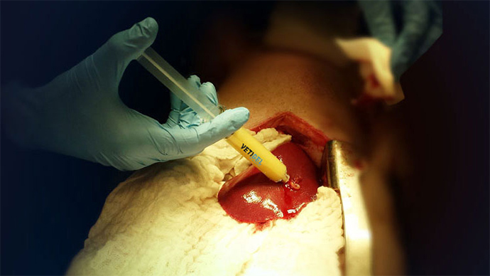 Plant-based gel can seal bleeding wounds instantaneously (VIDEO)