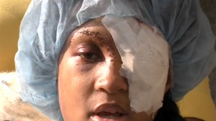 Pregnant woman loses eye from St. Louis County police bean-bag shooting
