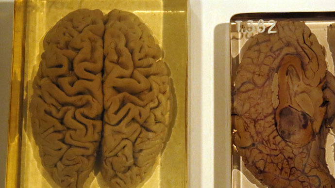Losing their minds: 100 brains go ‘missing’ from University of Texas