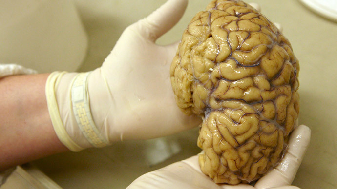 It’s a no-brainer: Texas 100 missing brains mystery solved