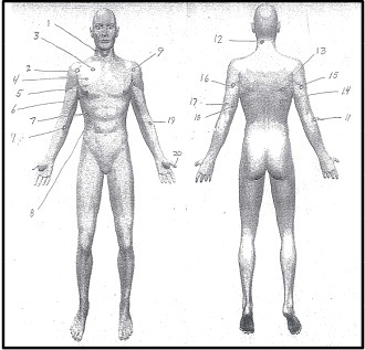 Bullet trajectories from Dontre Hamilton's autopsy (Milwaukee County District Attorney's Office report)