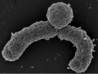 A previously uncultured bacterium, Eleftheria terrae, makes teixobactin, a new antibiotic.(William Fowle/Northeastern University)
