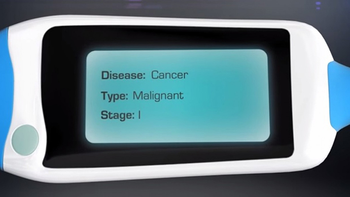 Phoning-in lung cancer: SNIFFPHONE to give diagnosis from single breath