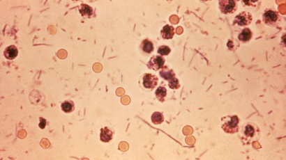 'Phantom menace' superbug is becoming more common in the US – CDC
