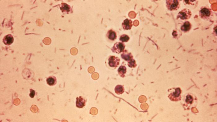 Antibiotic-resistant superbug has spread to majority of US states – CDC