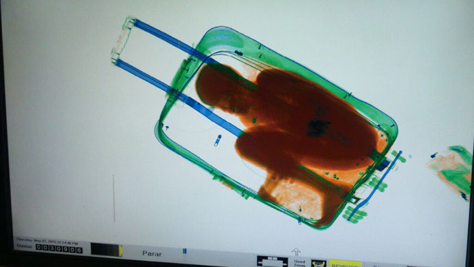 African boy smuggled to Spain… in suitcase (PHOTOS)