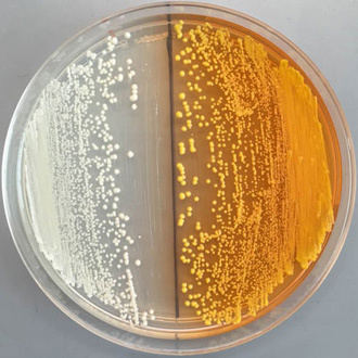 On the right are yeast cells producing the yellow beet pigment (image by UC Berkeley)