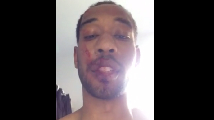 'I still love all!' Man beaten while defending community center gets inspiring support (VIDEO)