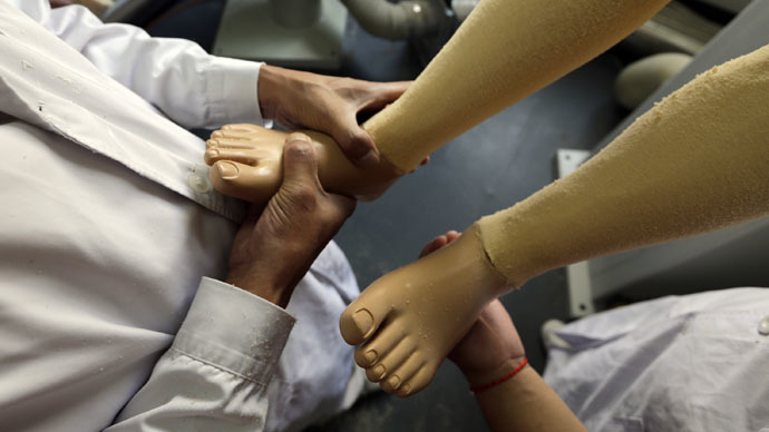 World’s 1st 'feeling' prosthetic leg unveiled in Austria