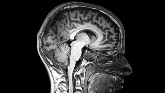 ​Scientists get first-ever visual glimpse into how new concepts form inside brain