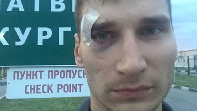 Russian journalist arrested, beaten, deported from rebel E. Ukraine