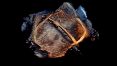​Revolutionary 4D images of human heart (PHOTOS, VIDEOS)