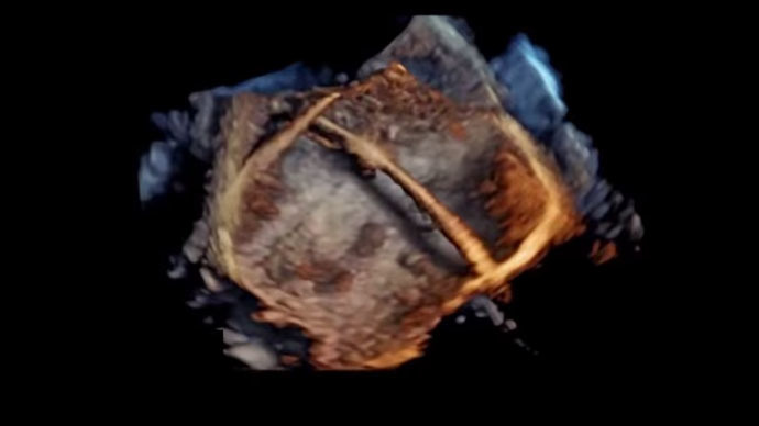 ​Revolutionary 4D images of human heart (PHOTOS, VIDEOS)