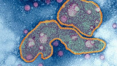 ‘Humdinger’: Swine flu virus which killed half-million modified to 'incurable'