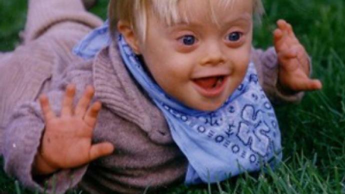 Facebook page unites anti-Down Syndrome activists, sparks controversy