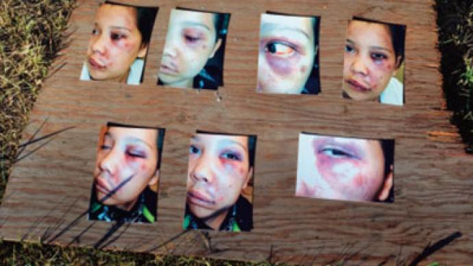 Canadian police face multiple 'sexual abuse' accusations from aboriginal women - HRW