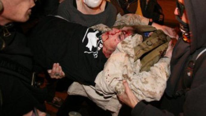 Veteran in critical condition after police assault at Occupy Oakland