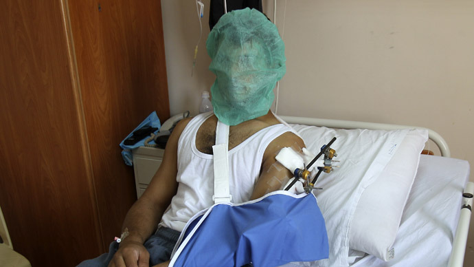 A Syrian man brought into Jordan for medical treatment lies on a bed after undergoing multiple reconstructive surgeries at the Red Crescent Hospital in Amman July 19, 2012 (Reuters / Ali Jarekji)