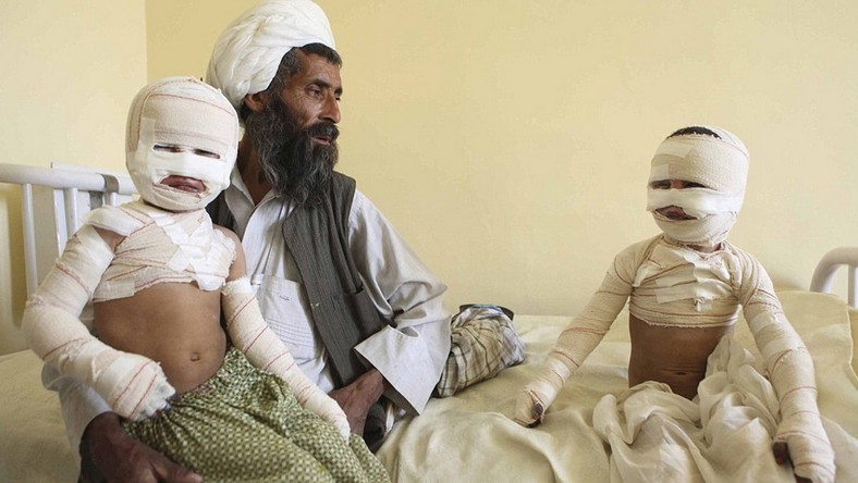 Les enfants continuent de payer le plus lourd tribut aux mines antipersonnel en Afghanistan (PHOTOS)