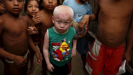 Malawi: un instituteur arrêté alors qu'il s'apprêtait à monnayer une lycéenne albinos