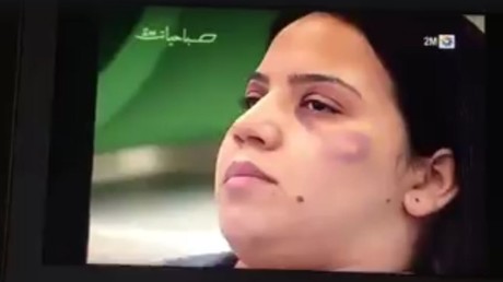Maroc : quand la TV apprend aux femmes battues à dissimuler leurs hématomes, ça ne passe pas (VIDEO)