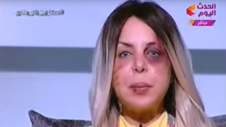 Une journaliste égyptienne apparaît le visage tuméfié à la télévision