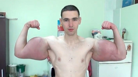 Des muscles gonflables : un blogueur russe s'injecte du synthol dans les bras pour être «en forme»