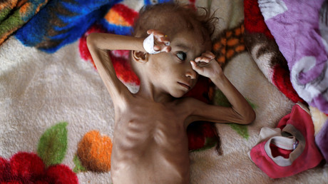 Yémen : jusqu'à 14 millions de personnes pourraient souffrir de la famine, selon l'ONU