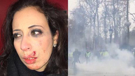 Acte 5 des Gilets jaunes : une journaliste de RT France blessée par un projectile à Paris