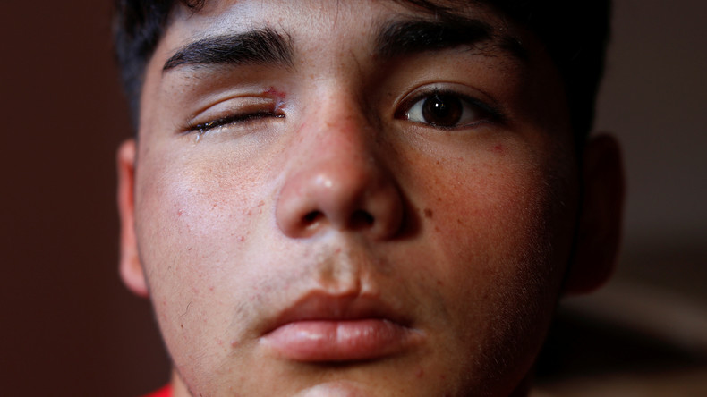 Chili : les forces de l'ordre suspendent l'utilisation des balles en caoutchouc