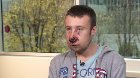 Julien, journaliste indépendant blessé au visage place d'Italie, témoigne