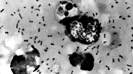 Cette image du Centers for Disease Control (CDC), obtenue le 15 janvier 2003, montre des bactéries de la peste bubonique prélevées sur un patient (image d'illustration).