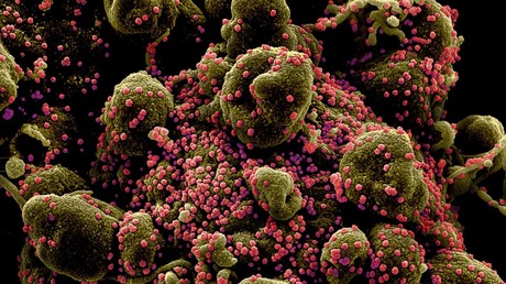 Micrographie électronique colorisée d'une cellule apoptotique fortement infectée par le nouveau coronavirus (image d'illustration).