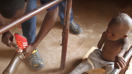 Un centre de rééducation redonne de l’espoir aux enfants blessés dans le conflit en Centrafrique