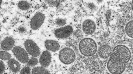 Un premier cas d'infection à la variole du singe confirmé en France