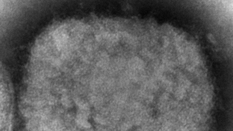 Image prise au microscope électronique en 2003, montrant un virion de la variole du singe (image d'illustration).