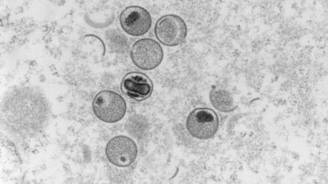 Une capture microscopique électronique à section ultra-fine du virus de la variole du singe (image d'illustration).