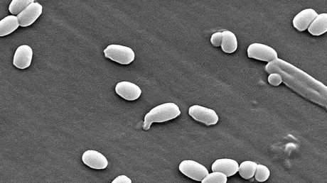 RDC : l’anthrax refait surface au Nord-Kivu avec le signalement de 8 cas suspects et 1 décès