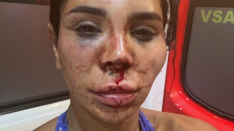 «Nous suspectons malheureusement qu’elle ait subi un viol» : une influenceuse victime d’un home-jacking à Marseille