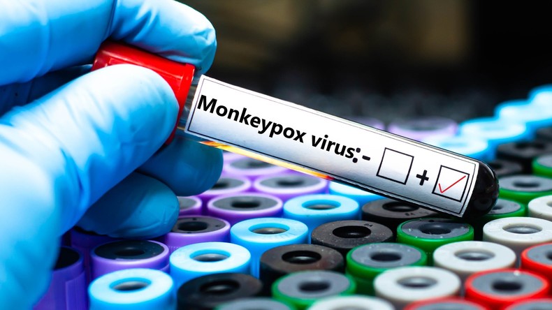 Mpox : l’Organisation mondiale de la santé signale une transmission active de la maladie dans 17 pays africains