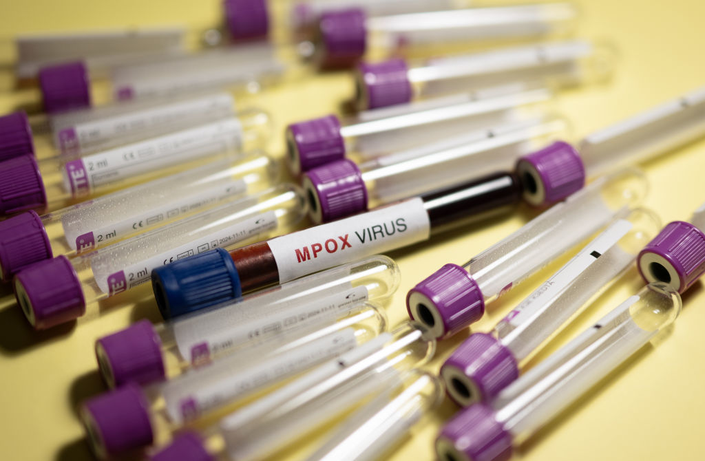 Deux cas de mpox détectés à Mayotte