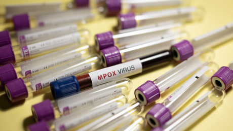 Tube contenant le virus mpox. [Photo d'illustration]
