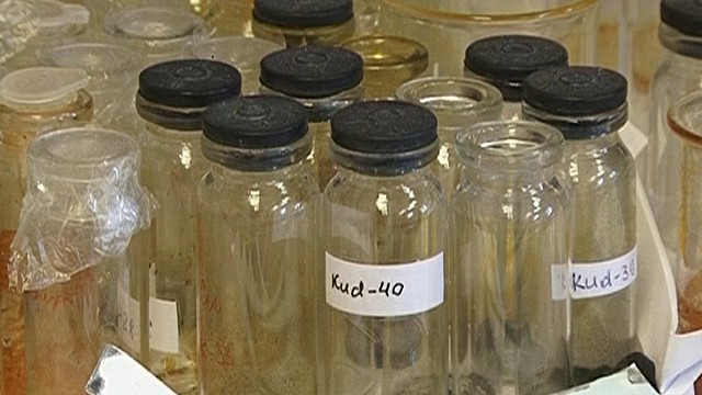 Российские и немецкие ученые открыли «туберкулезный суицид»