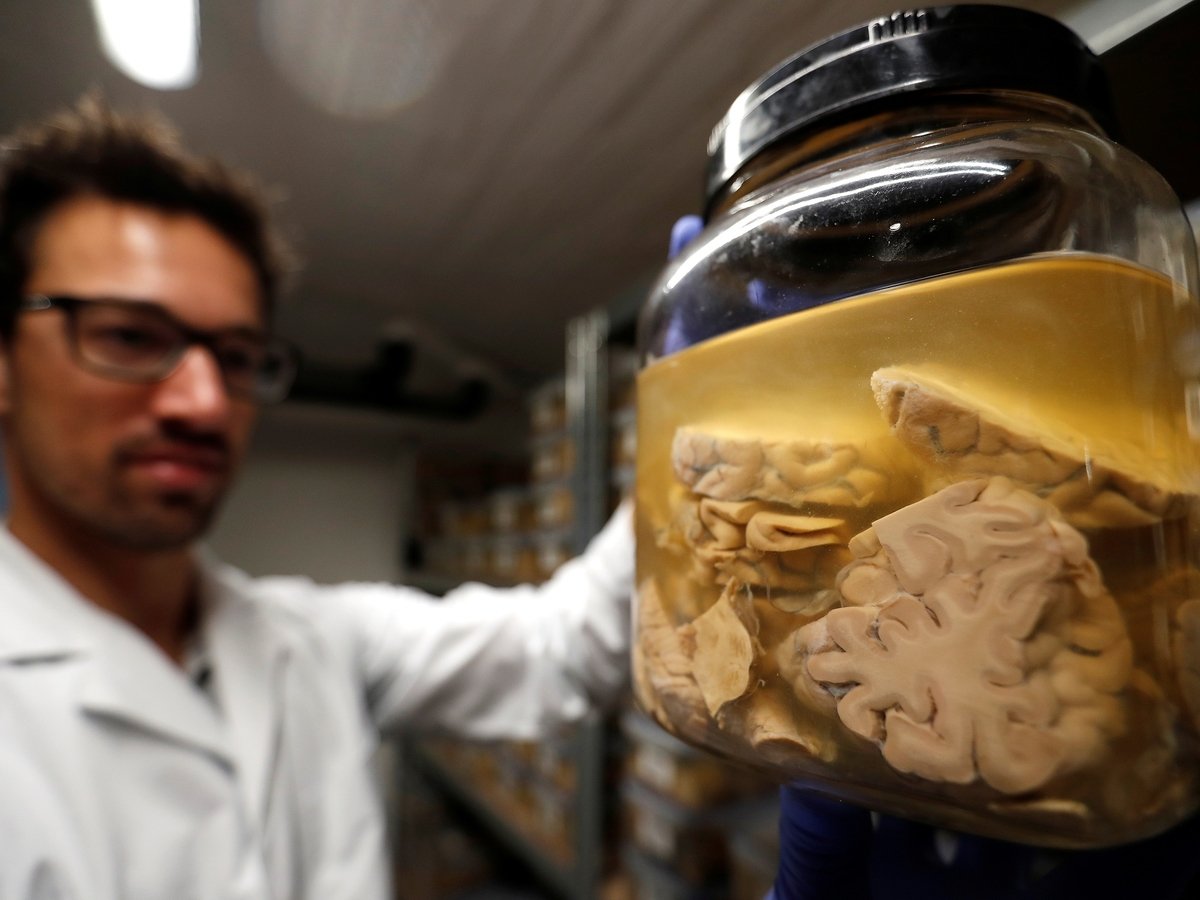 Учёные вырастили в лаборатории работающий мини-мозг